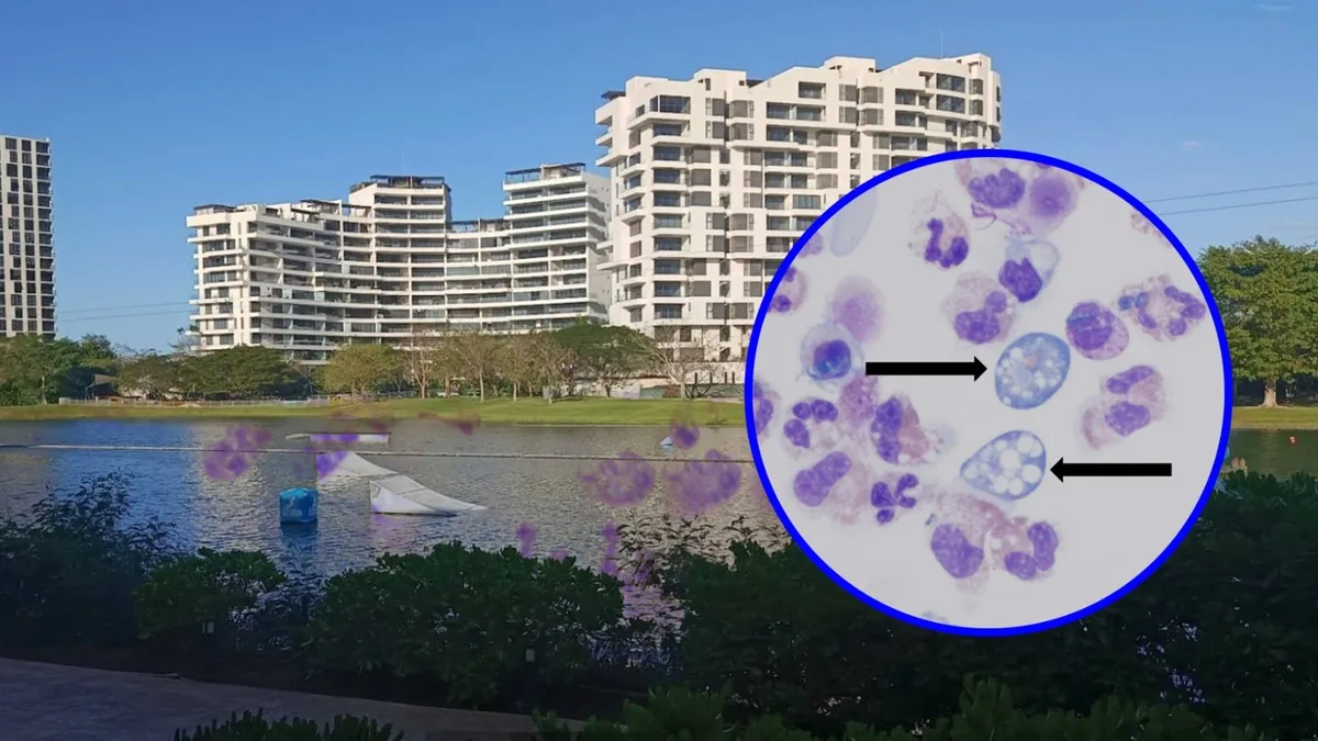 ‘Ameba comecerebros’ en México: Confirman su presencia en lago artificial de Plaza La Isla Mérida