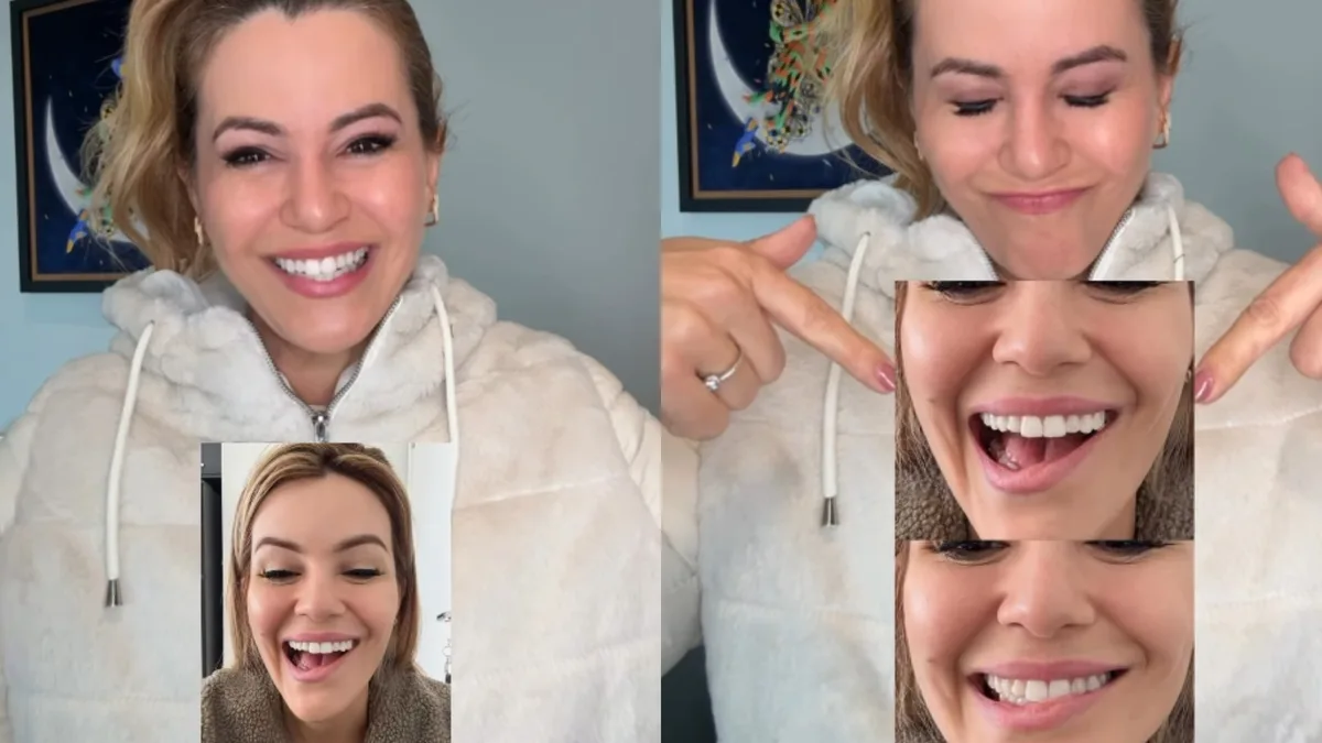 Musa do Carnaval de SP revela que teve nervo facial afetado após retirada de tumor na tireoide