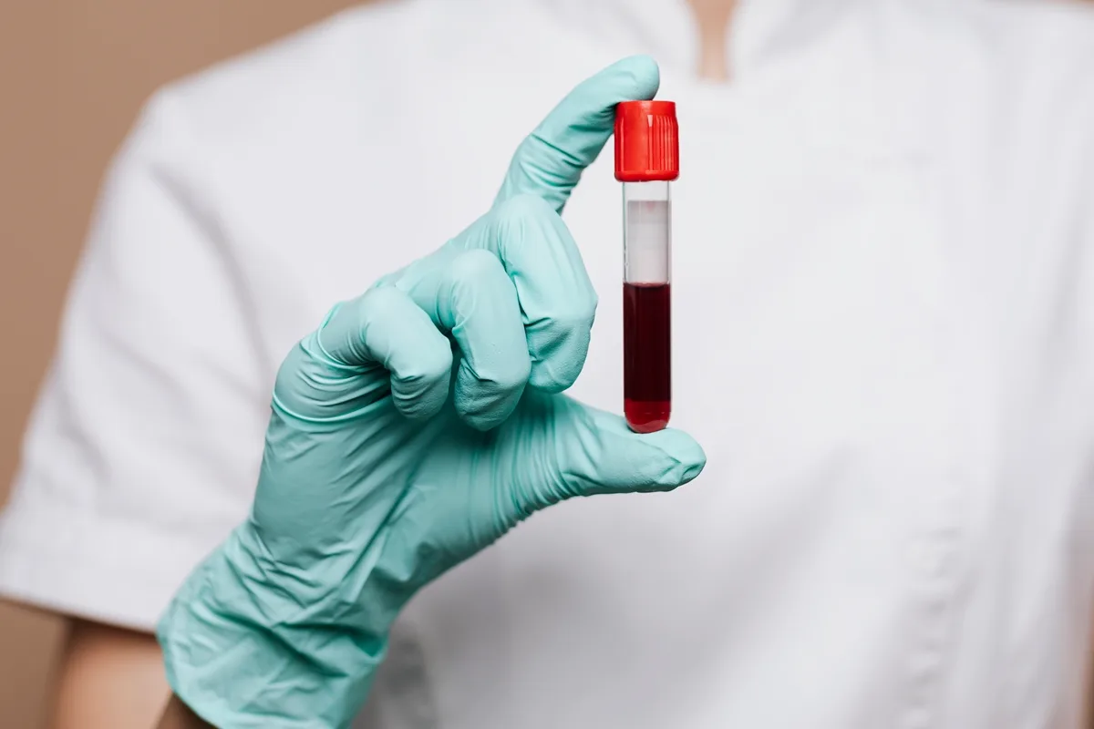 Estudo investiga se há risco de transmissão do Alzheimer pelo sangue