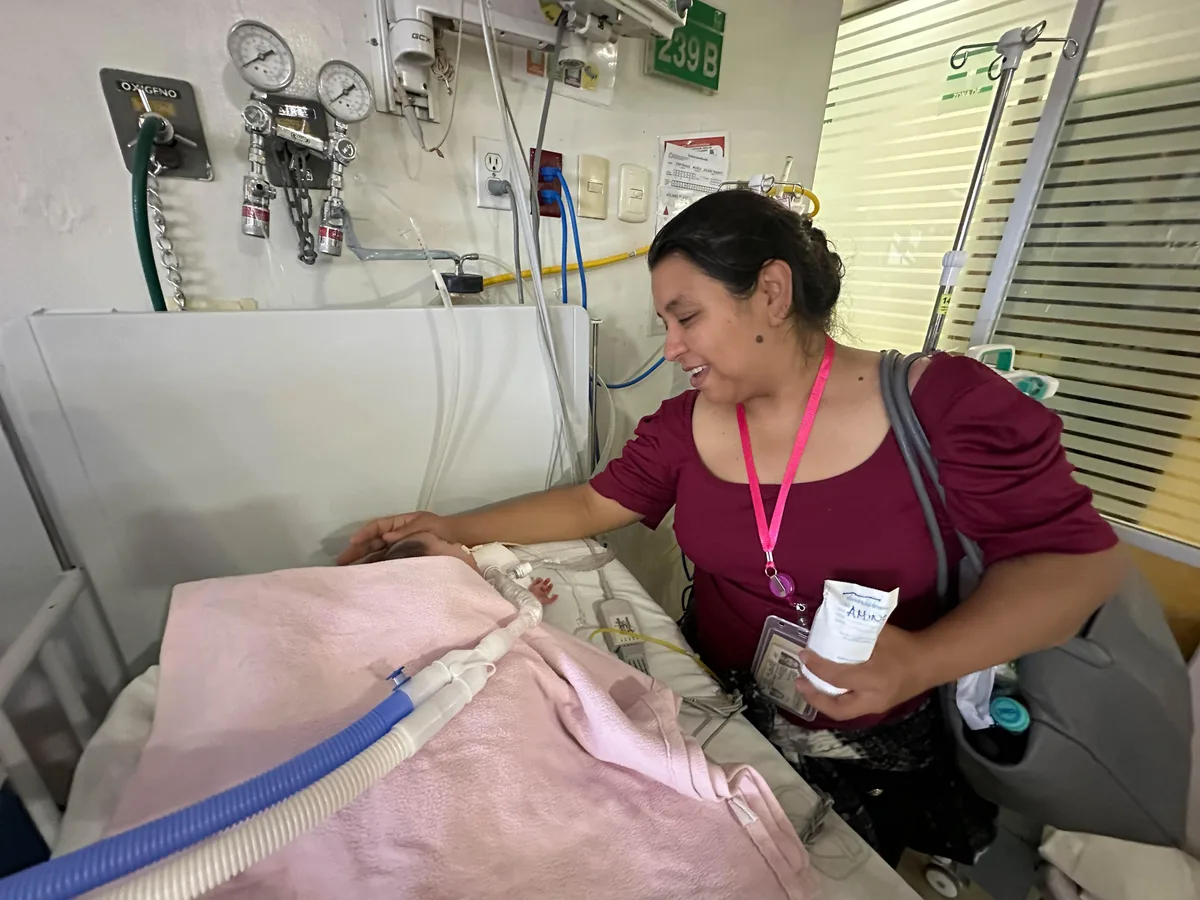 Bebé de Torreón sobrevive a quiste laríngeo tras cirugía especializada en el IMSS de Jalisco