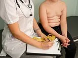 Children as young as 10 should be offered fat jabs, says World Health Organisation