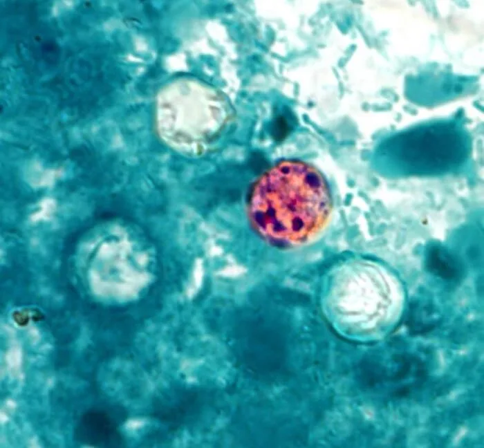 Trump admin shelves Cyclospora research despite record-breaking outbreak