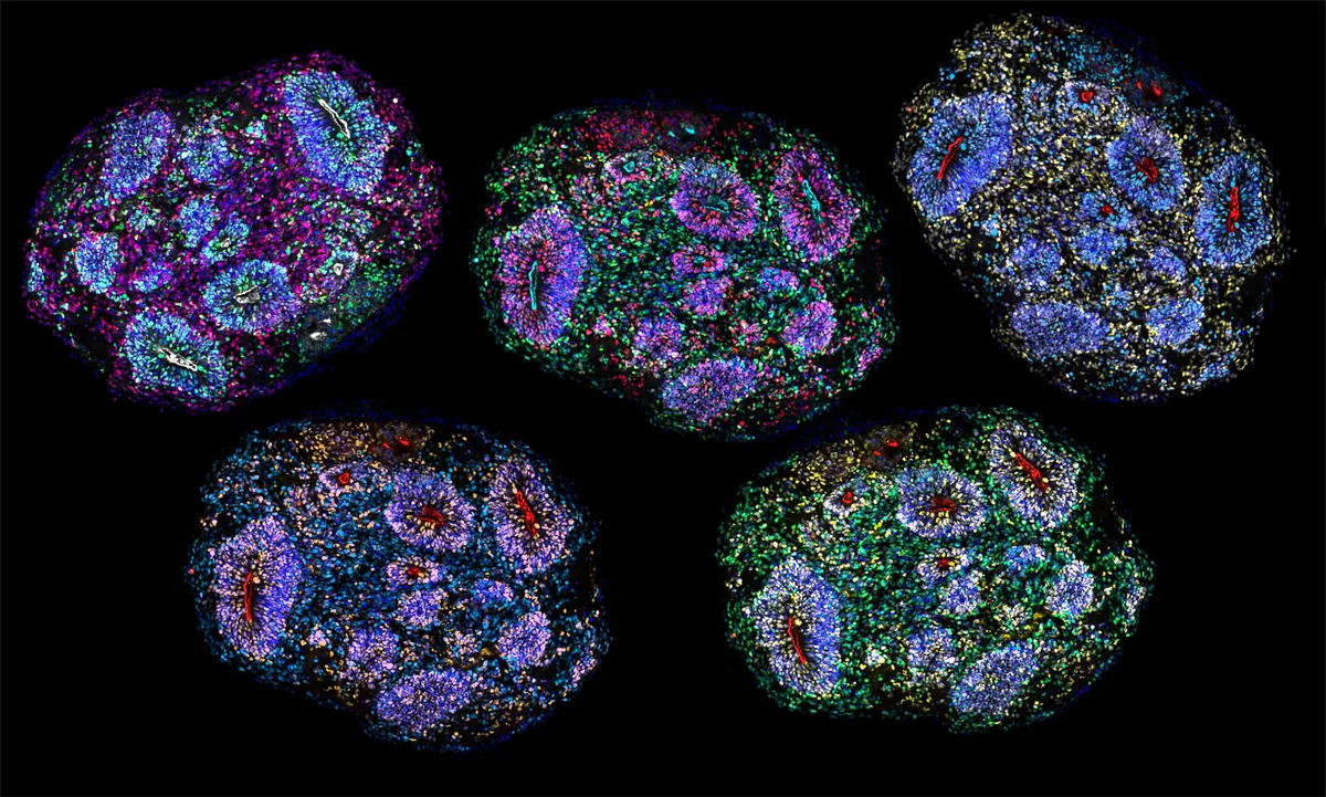 Revolución en neuromedicina al lograr minicerebros humanos que se mantienen vivos durante años