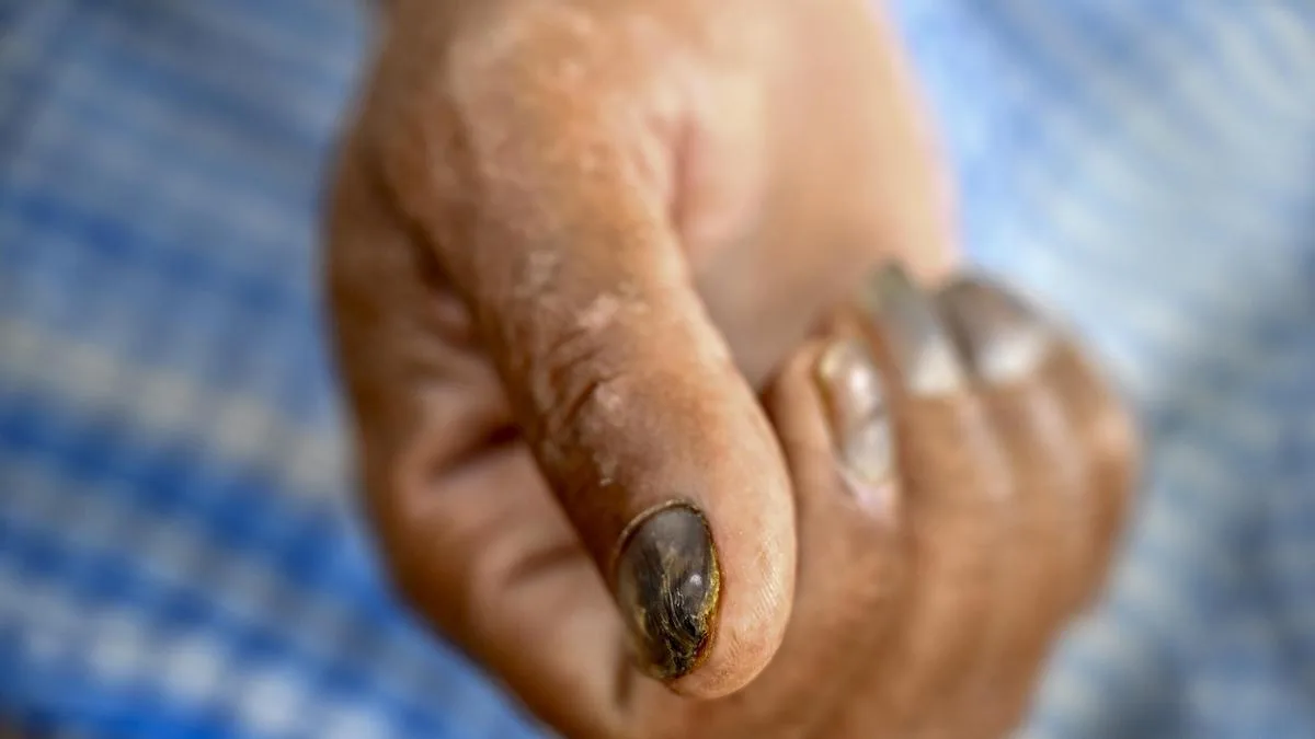 News in Frames | Toxic water runs deep