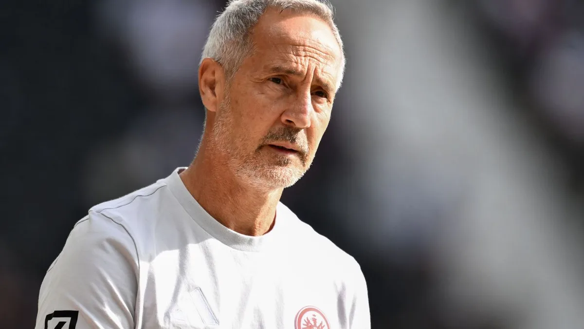 Fußball: Eintracht Frankfurt vor Leipzig mit Systemfrage