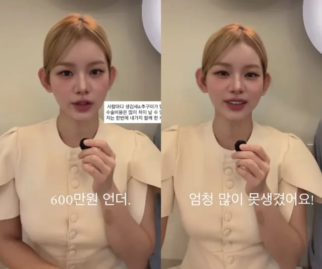 맹승지, 인중 성형에 600만원 들였다.."한달동안 진짜 못생겨" 후기