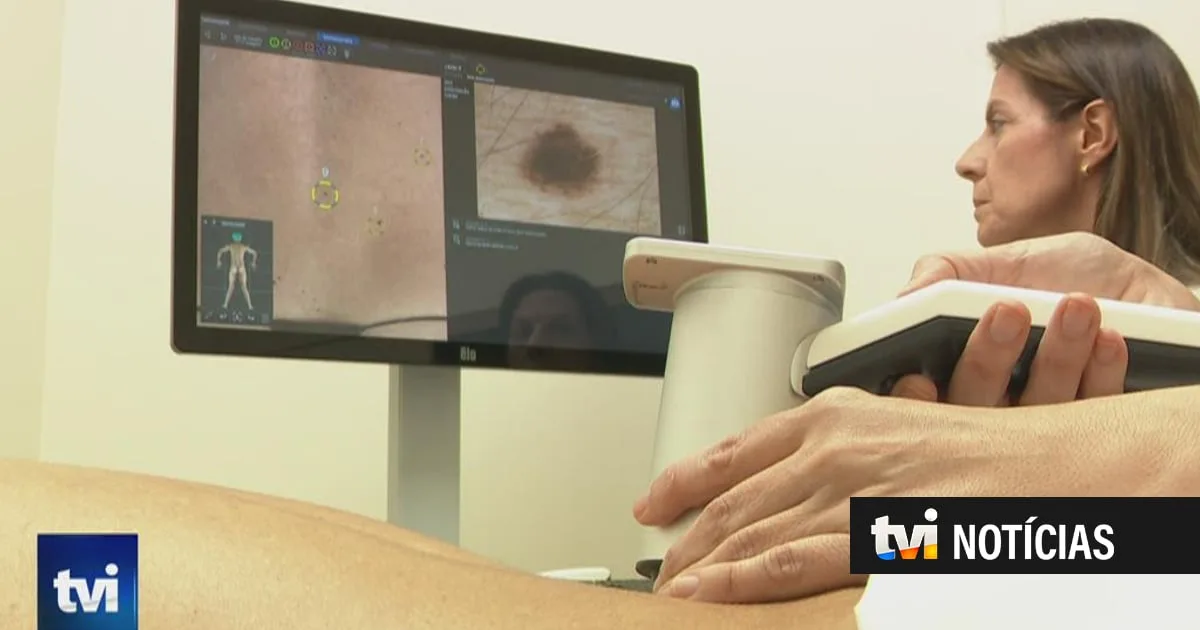 Três doentes do IPO participam no ensaio clínico "revolucionário" para testar vacina contra o melanoma