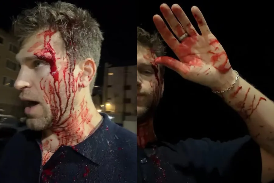 Keegan Allen, actor de Pretty Little Liars, sufrió un robo a punta de pistola y cuchillo en California: “Mi vida por un reloj”