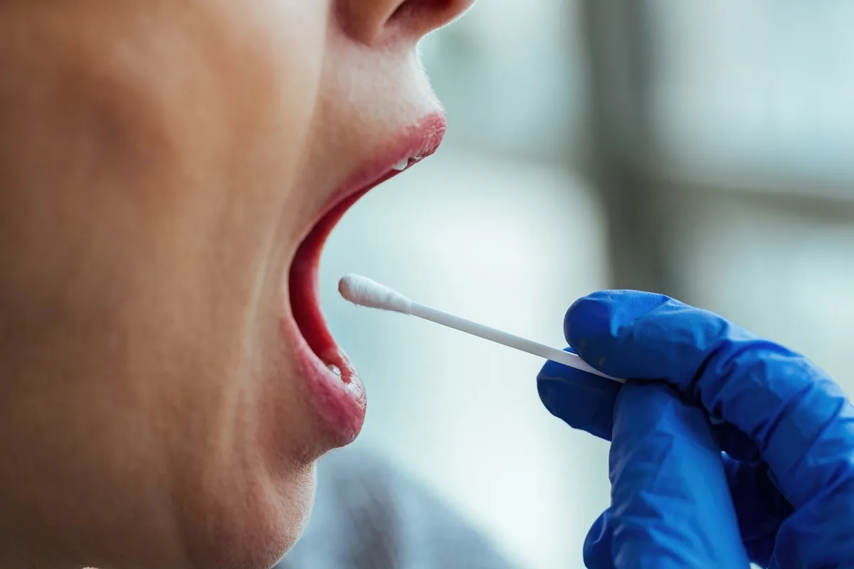 Análise da saliva pode identificar sinal ligado ao câncer colorretal