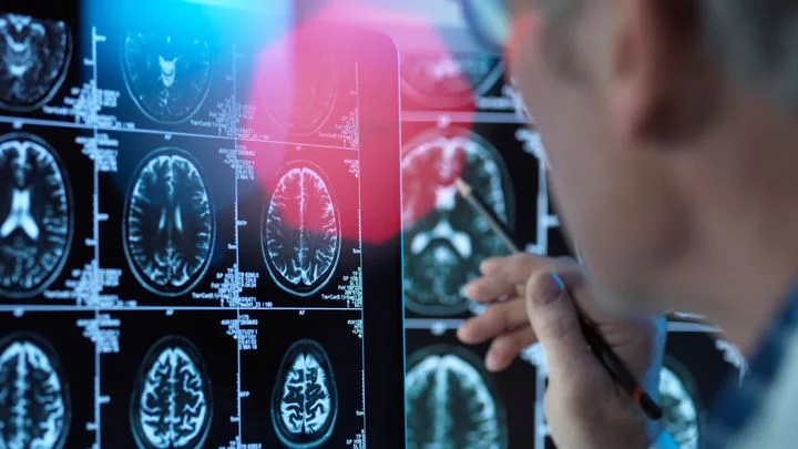 Comment la prise en charge de la maladie d'Alzheimer a-t-elle évolué ?