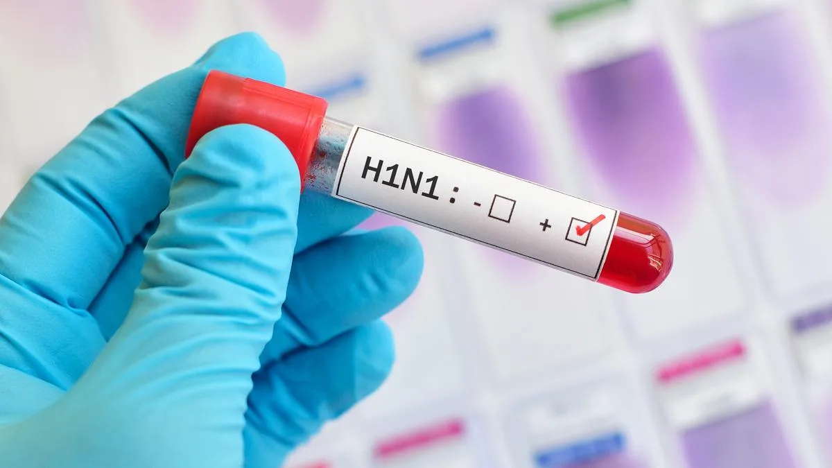 Jharkhand health department sounds alert after 8 persons tested positive for swine flu