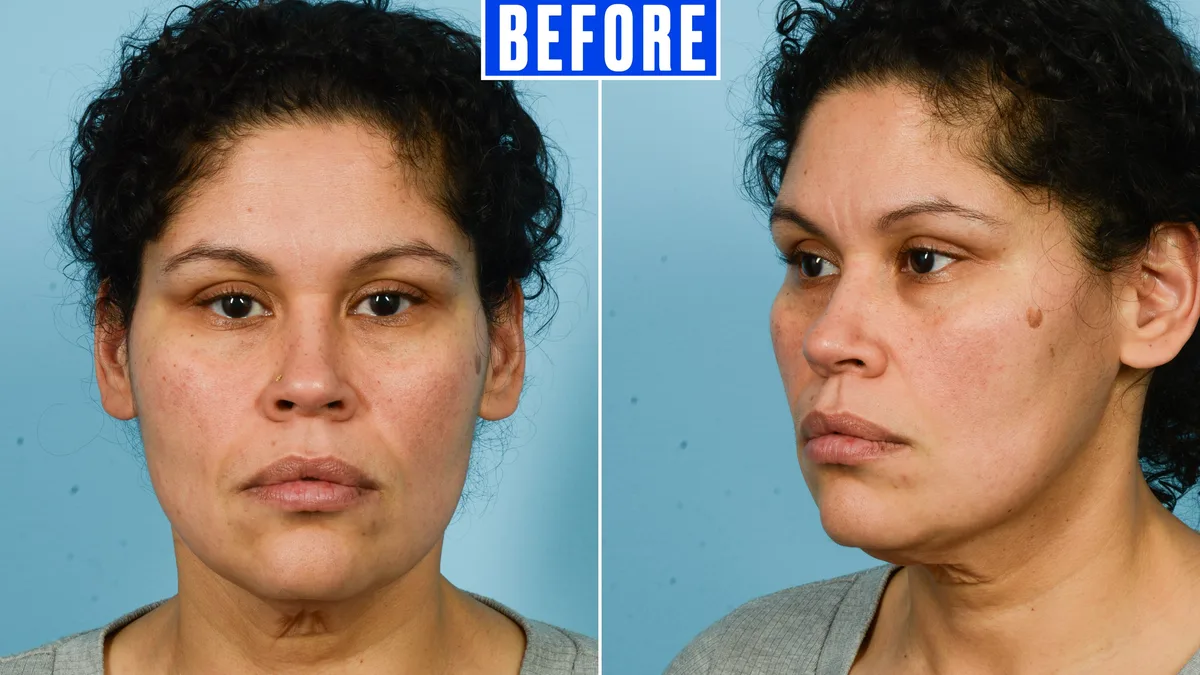 Bride Drops 80 Pounds Before Making One More Dramatic Change