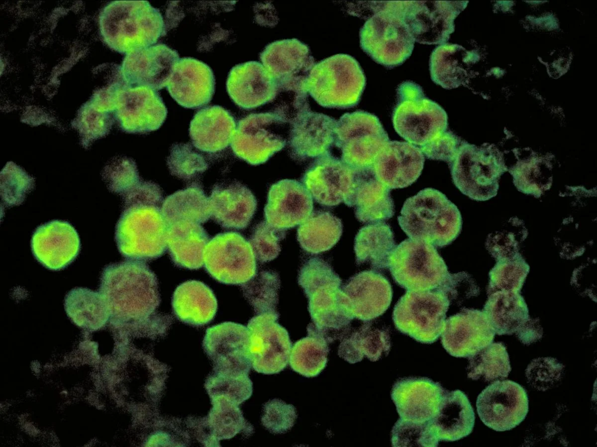 La claustrophilie des amibes "mangeuses de cerveau"