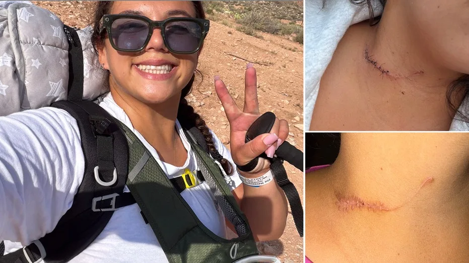 ‘Never give up a fight’: NYC mom shows her kids 5, 7 the scars from neck-slash attack as lesson in survival