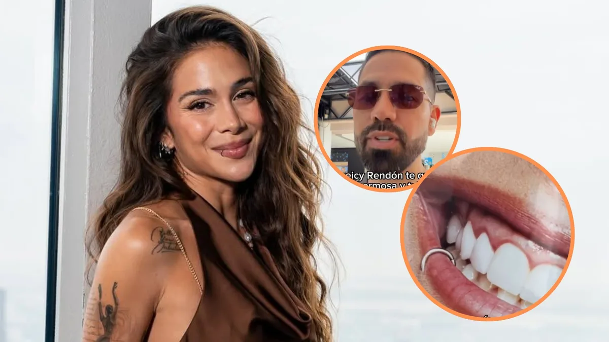 Odontólogo lanzó alerta sobre la salud dental de Greeicy Rendón: “Tiene una infección”