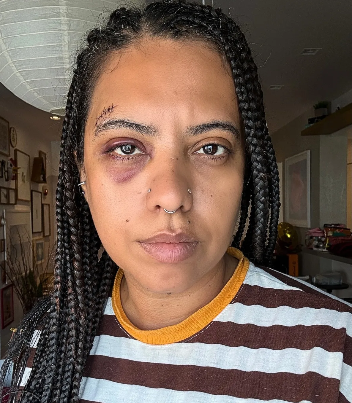 Influenciadora leva seis pontos após agressão em roda de samba no Rio