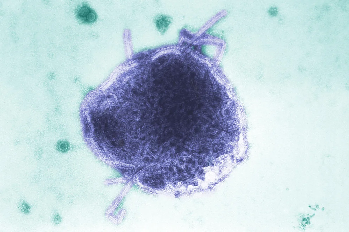 Infant in Pennsylvania is one of two people reported to die of measles this week