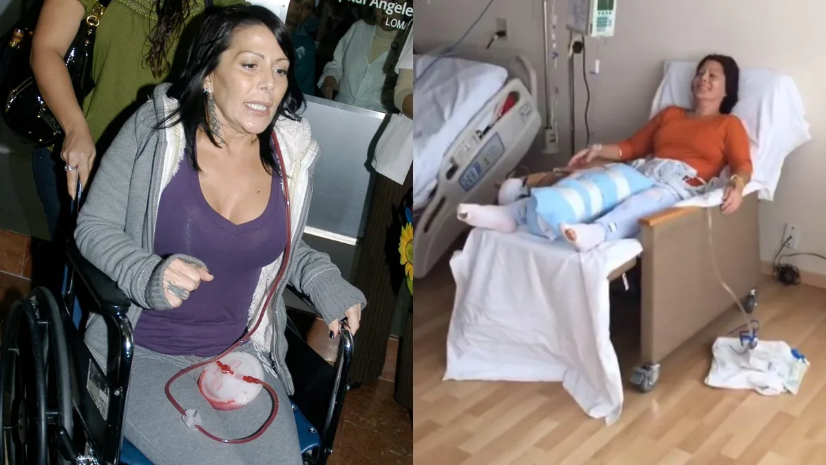 Polímeros y prótesis de titanio: los duros problemas de salud de Alejandra Guzmán que provocan que se “zafe” su cadera