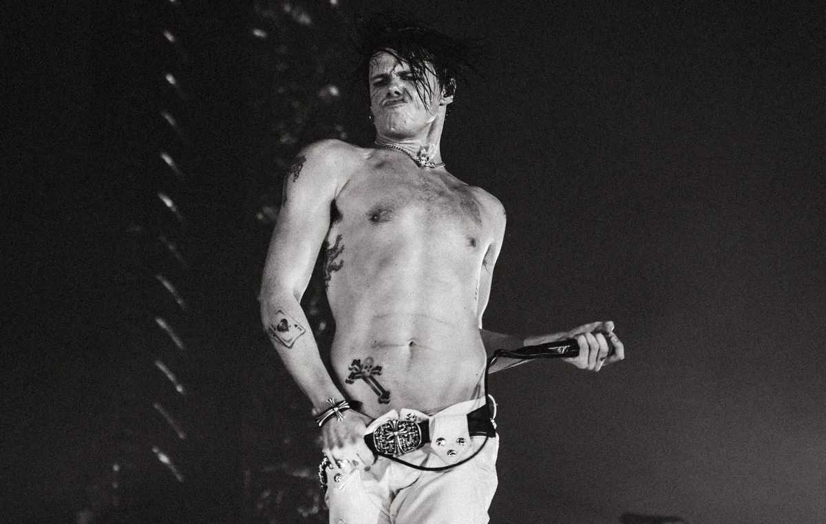 Yungblud breaks his leg in motorbike accident, vows to still play European festivals this week