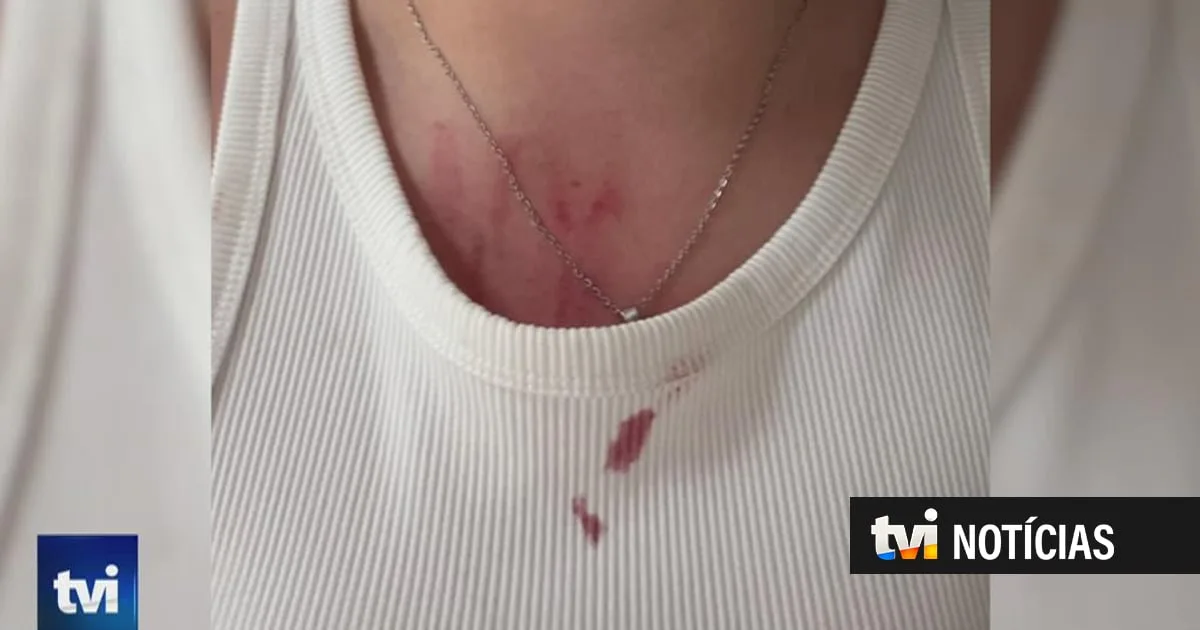 Funcionárias de casa de acolhimento em São Miguel repetidamente agredidas por duas jovens com problemas psicológicos