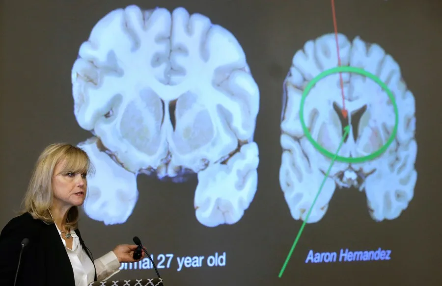1 in 4 NFL players suffer from brain disease. Where is the accountability?