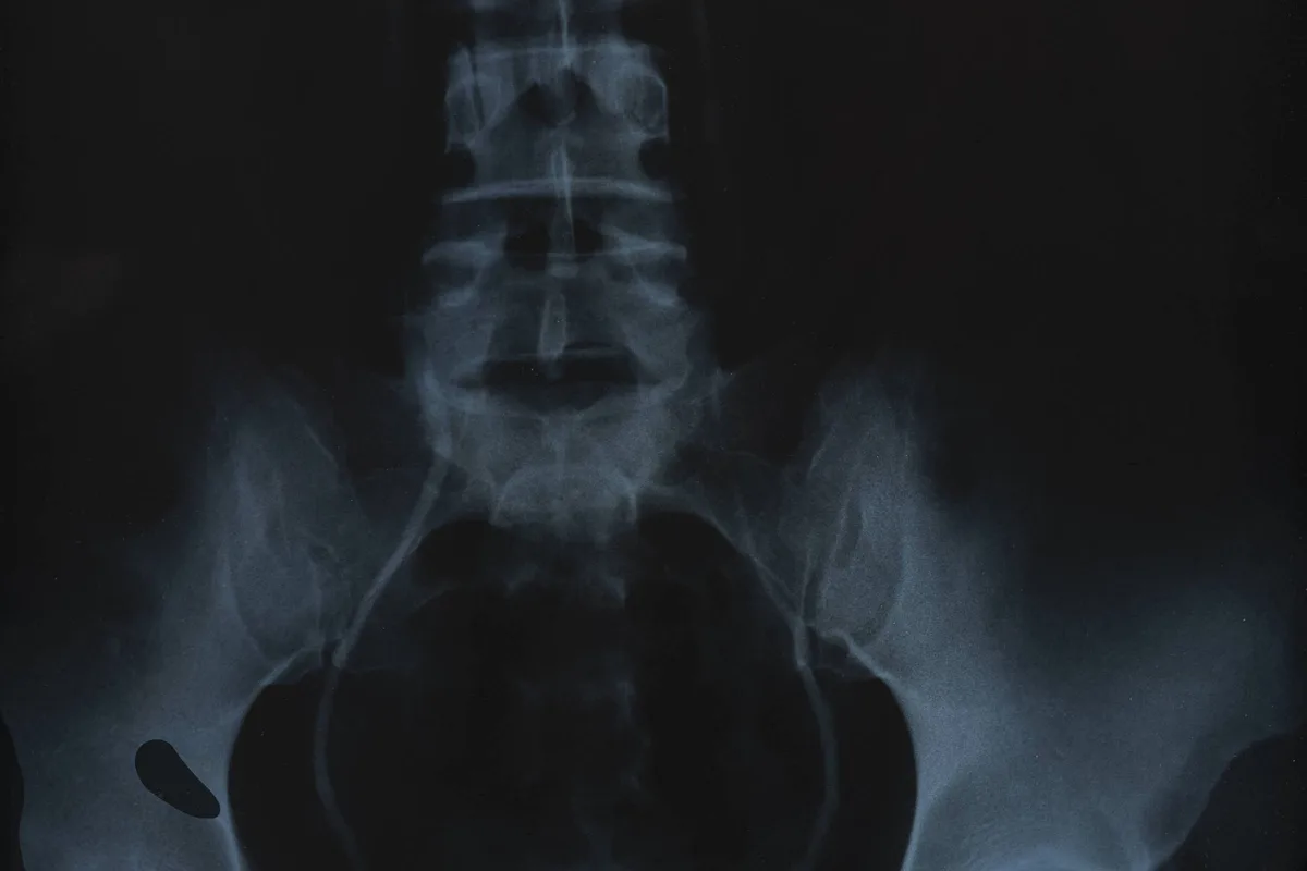 Anna Maria Maiolino ganha exposição em que usa a arte para radiografar o corpo