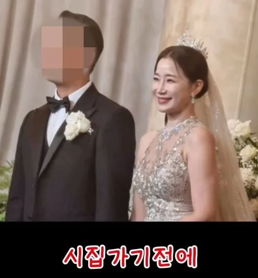 '서프라이즈' 김하영, 지방흡입 했다 "결혼식 때 12kg 뺐는데 팔뚝만"