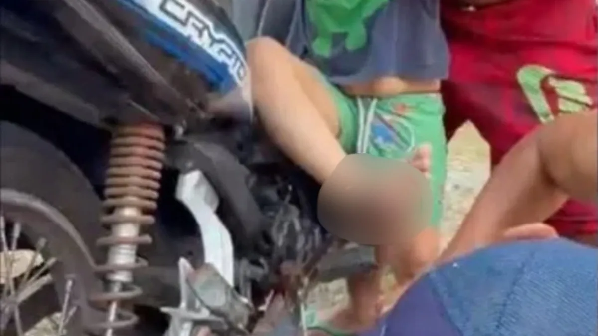 Menino de 4 anos tem pé perfurado e preso em pedal de motocicleta após veículo tombar no AM
