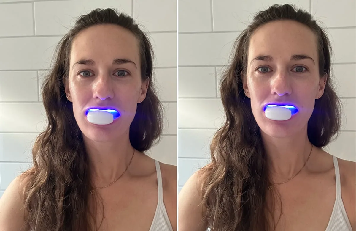 I used this LED teeth whitening kit for 7 days – here’s what happened