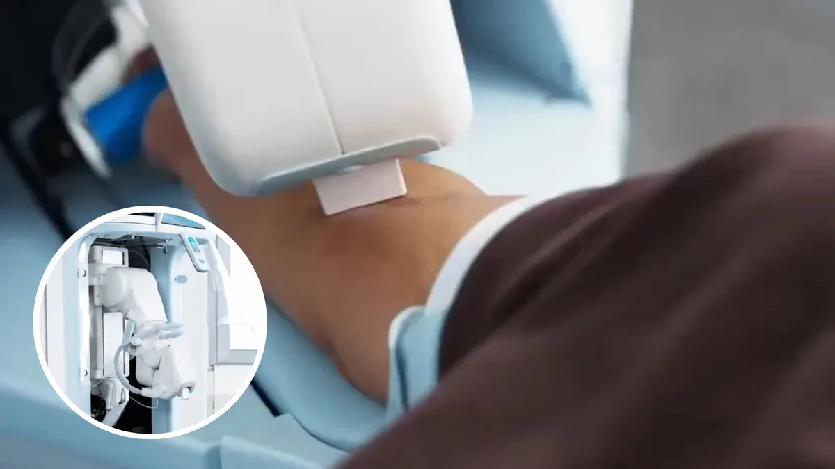 Brazo robótico distingue arterias de venas para extraer muestras de sangre sin riesgo