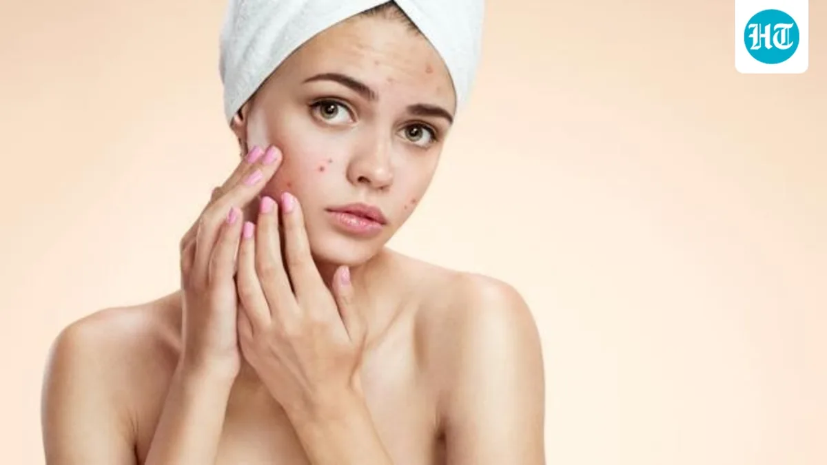 Dermatologist Dr Rinky Kapoor says sensitive skin is for real and explains 1/3rd of Indians' skin can't handle skincare