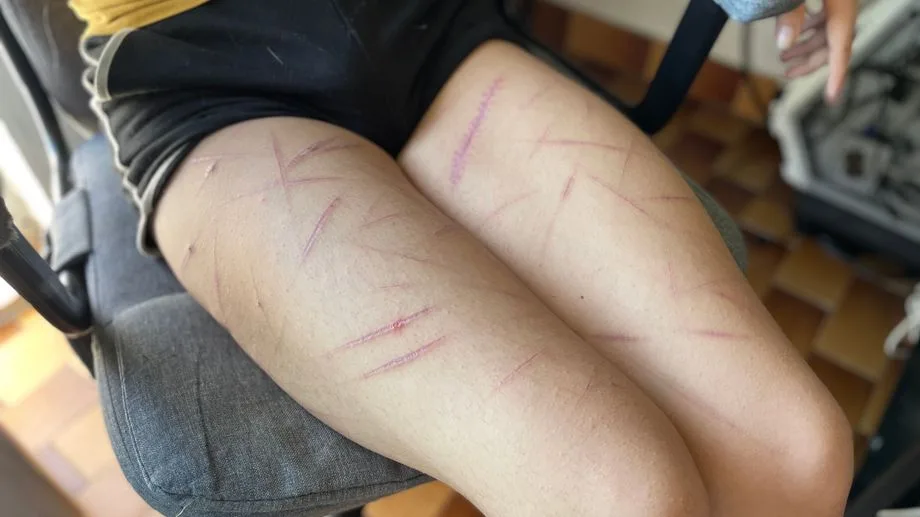 INFO ICI HERAULT - "J'ai failli mourir" : Ellie, 21 ans, témoigne après sa violente agression transphobe à Montpellier