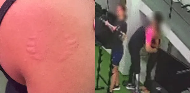 Mulher denuncia assédio após ser mordida por professor de academia em PE