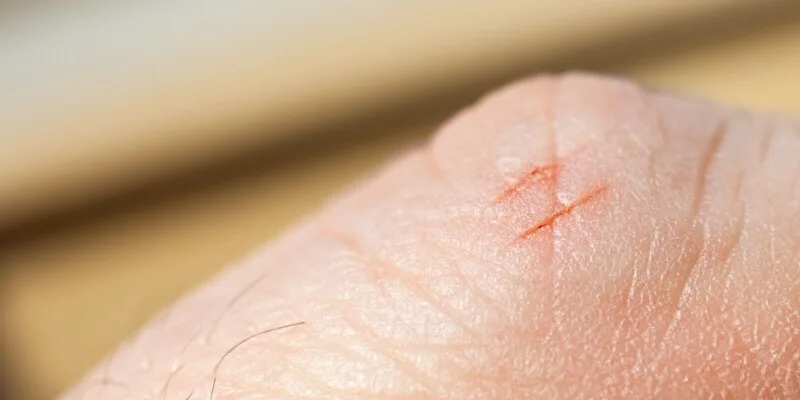 Print management outfit PaperCut is under 0-day attack, and it’s drawing customers’ blood