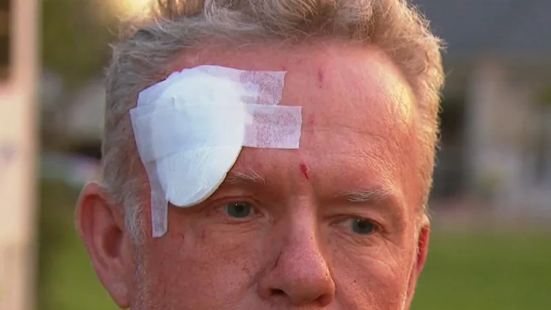 Tourist struck with angle grinder after confronting thief