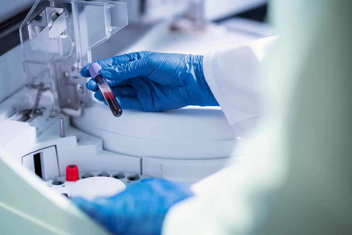Una terapia experimental elimina el cáncer metastásico de hígado en un niño de tres años