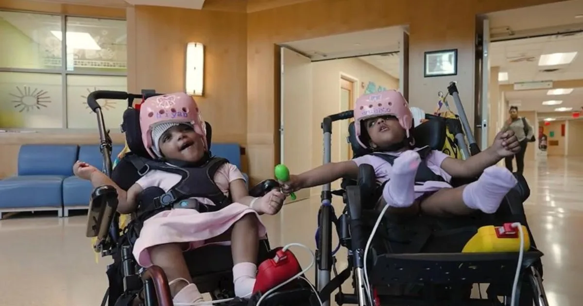 Hito de la medicina | Dos bebés siamesas unidas por la cabeza pudieron ser separadas tras una compleja cirugía de más de 24 horas en Estados Unidos: "Es realmente extraordinario"