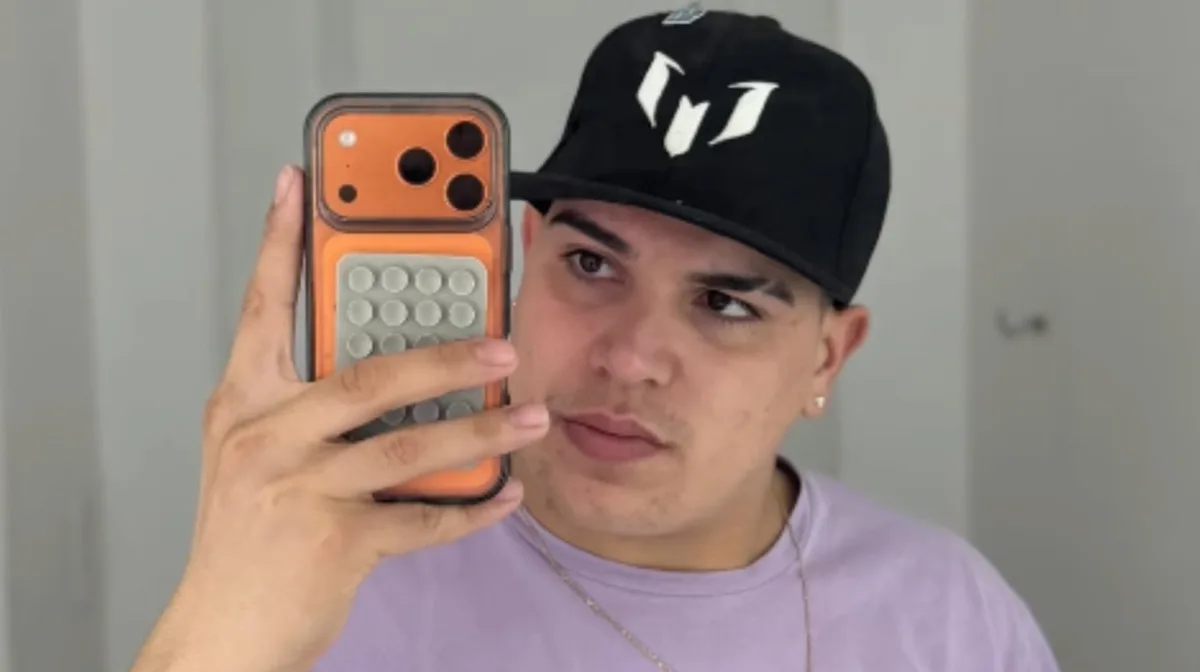 “Me da vergüenza”: Thiago Medina se sacó fotos sin remera y mostró las cicatrices que le quedaron tras su accidente