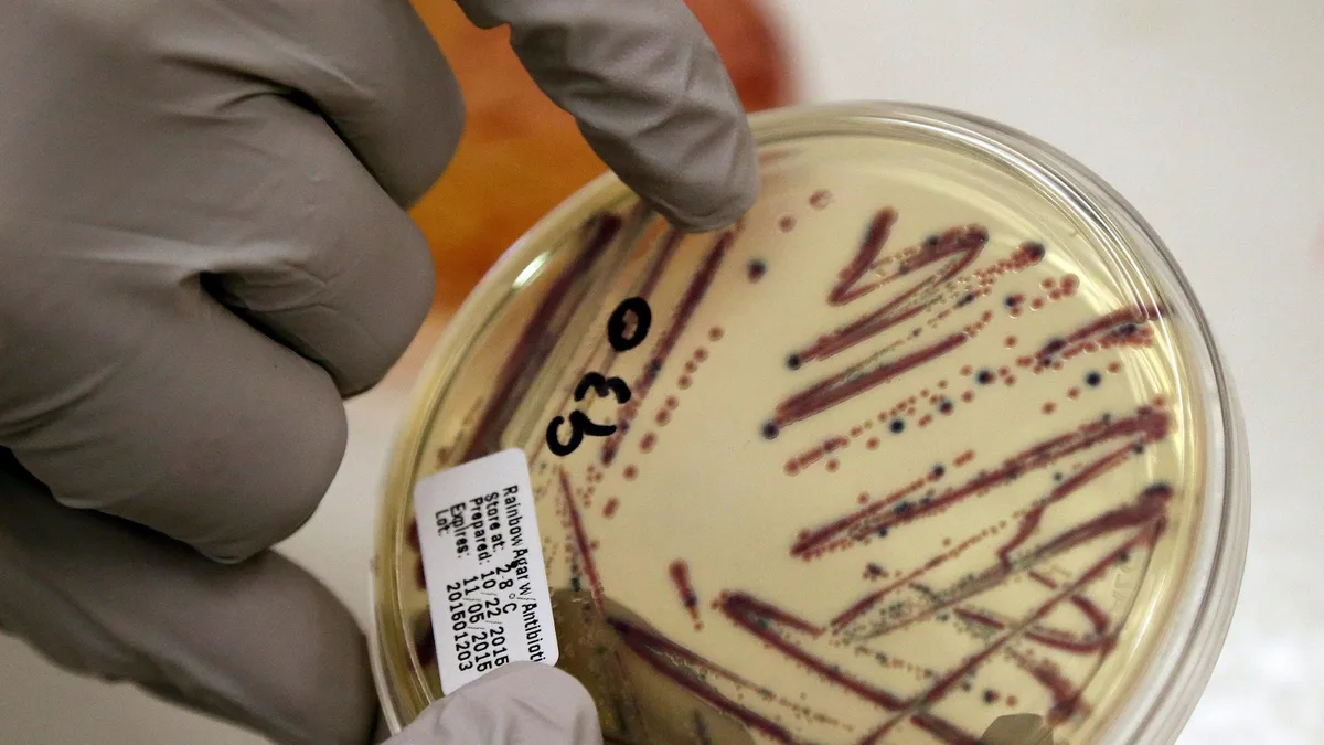 Alfalfa sprouts linked to food poisoning illnesses in these states