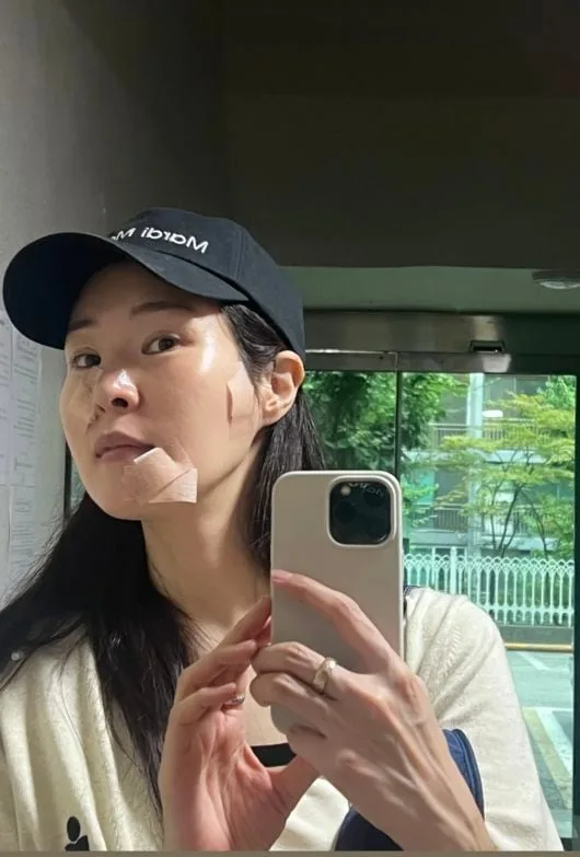 '김태현♥' 미자, 모친 욕실 낙상 사고 얼마나 됐다고..얼굴에 반창고 덕지덕지 '깜짝'