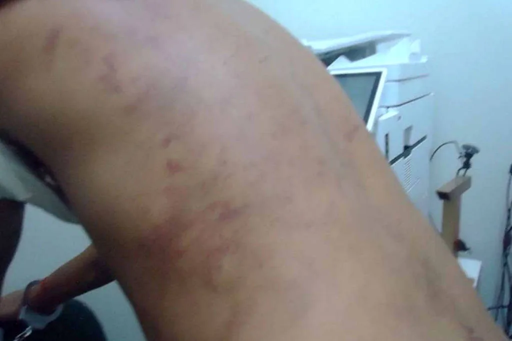 Ministério Público investiga denúncias de tortura por detentos em presídios do agreste de Pernambuco