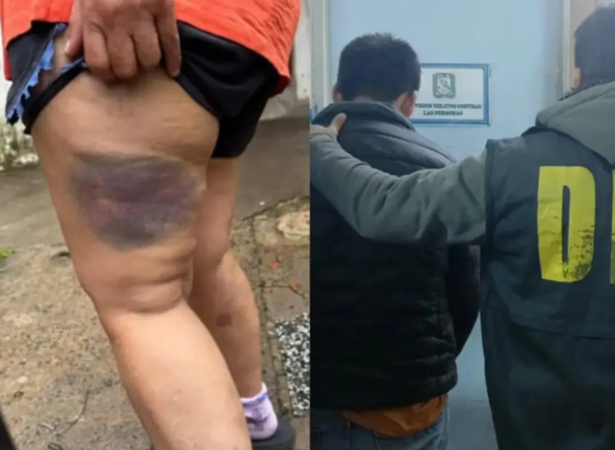 Tenía denuncias por violencia de género, atacó a su ex pareja con un garrote y fue detenido en Chaco