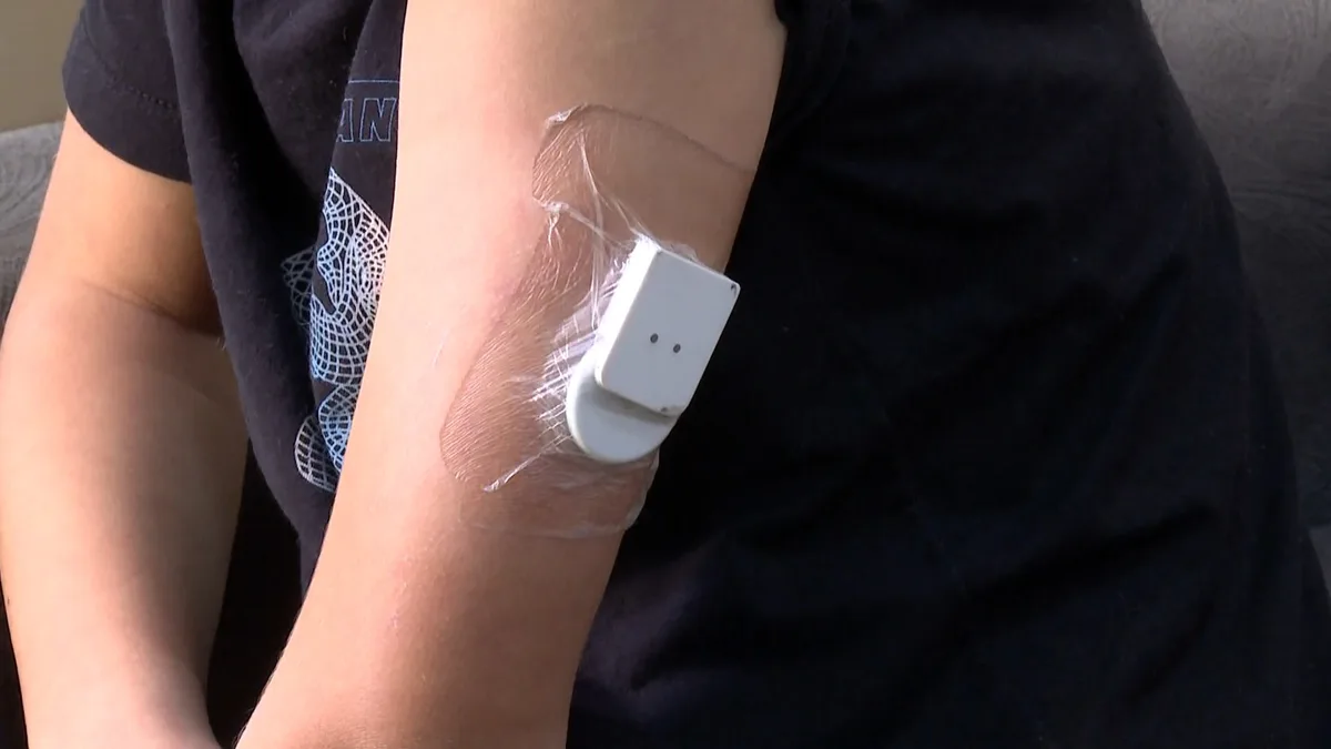 Guarujá entrega sensores de glicose a 86 crianças e adolescentes com diabetes; veja como funciona