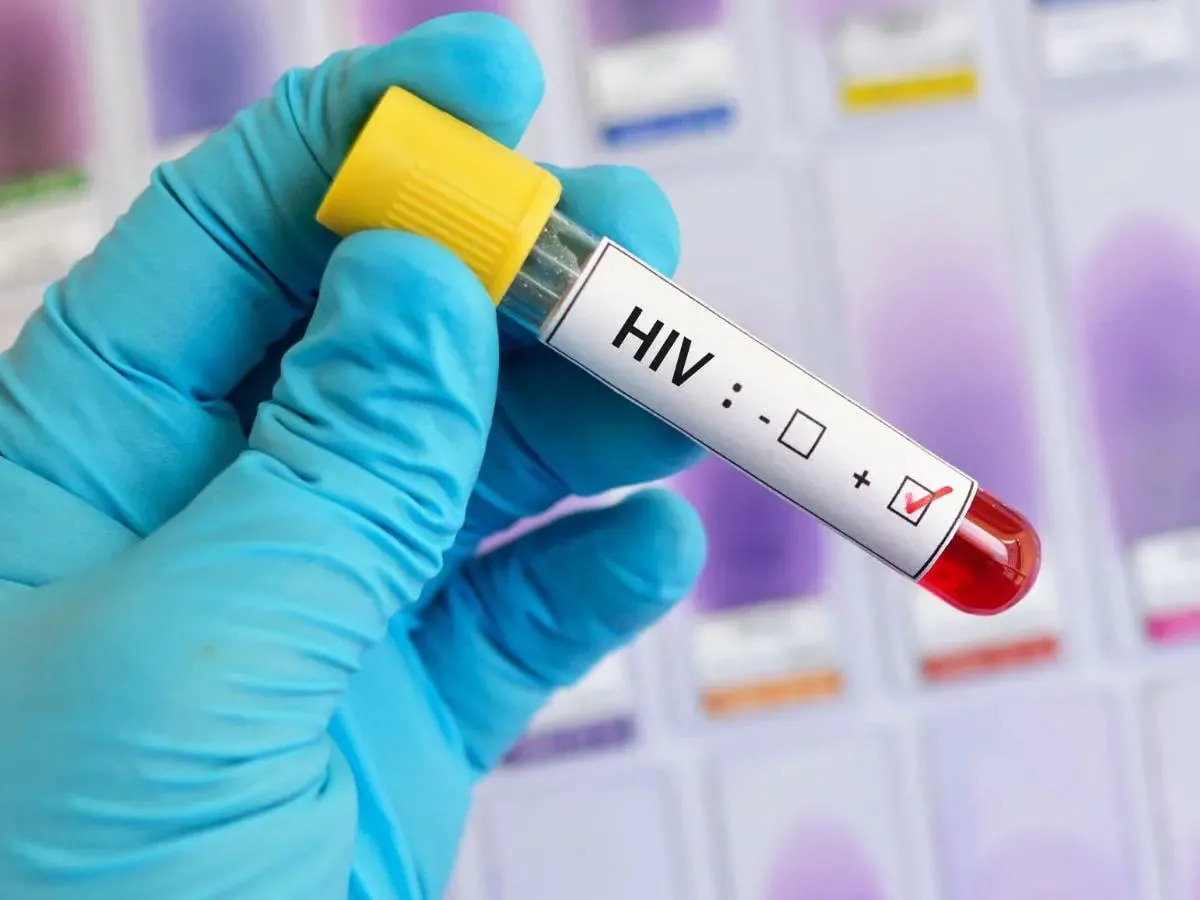 Ministerio de Salud destinó más de $24 millones a tratamientos para 17 mil personas con infección por VIH en el último año