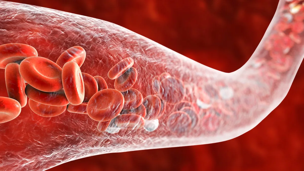4 Dinge, die Ihre Arterien zerstören – und 4, die sie gesund halten