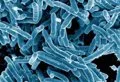Descubren que un gen ya conocido de la tuberculosis se activa bajo estrés