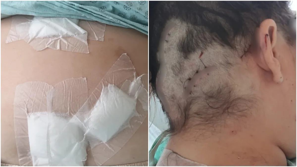 Mulher foi torturada e esfaqueada após companheiro ver conversa no celular dela sobre plano de sair de casa