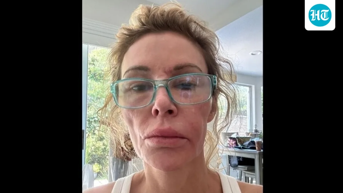 Brandi Glanville GoFundMe: RHOBH alum breaks down as Real Housewives stars donate for her treatment, ‘I’m embarrassed’