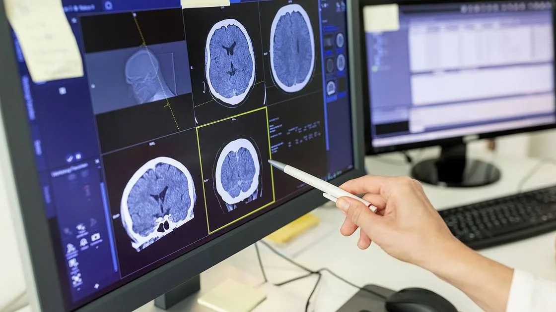 11 anos de quimioterapia depois, descobriu que afinal não tinha o tumor cerebral que lhe diagnosticaram