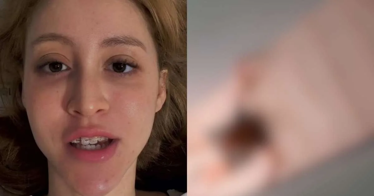 Influenciadora pede orações após sofrer fratura grave: 'Orem por mim'